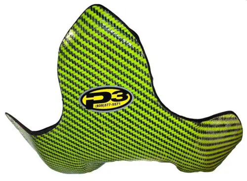 Kawasaki Carbon Fiber Skid Plate - Durable Protection kawasaki carbon fiber skid pla 0 1750486327 - BTOSPORTS